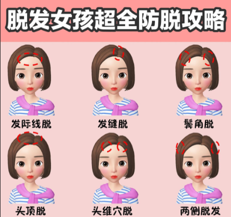 南寧美發(fā)學(xué)校：脫發(fā)女孩超全面的防脫攻略