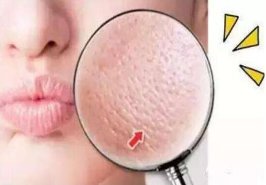 南寧美容學(xué)校：收縮毛孔的美容技巧