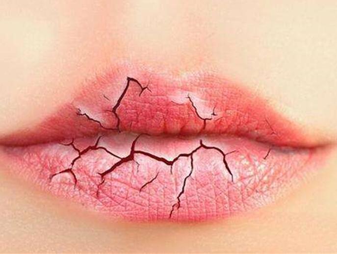 6個(gè)美容技巧，解決秋季嘴唇干燥