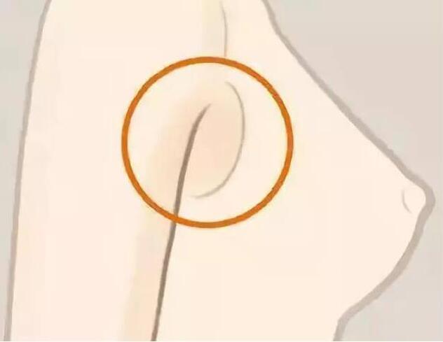 減副乳，瘦手臂一招就解決！