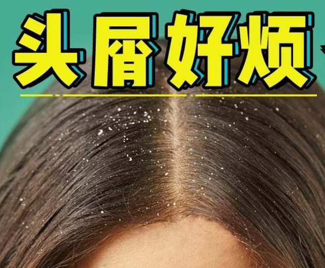 南寧正規(guī)美發(fā)培訓學校分享：冬天如何減少頭屑過多？