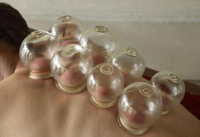 南寧美容培訓課程：拔罐后的罐印顏色代表什么