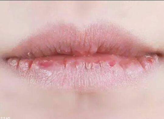 紋唇后嘴巴干燥怎么辦？南寧教紋繡的學(xué)校幫你解決