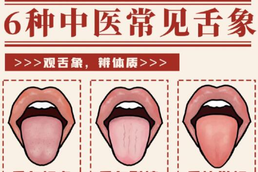 6種常見中醫(yī)舌診判定，快和廣西中醫(yī)美容一起學(xué)
