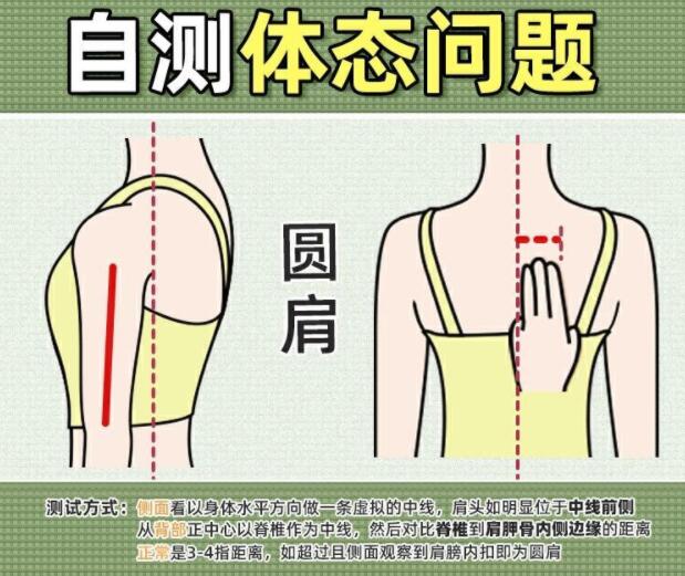 你真的是駝背嗎？廣西美容美體學(xué)校教你自測