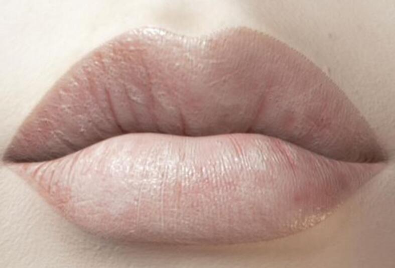 南寧皮膚管理師職業(yè)：唇周暗沉解決方法