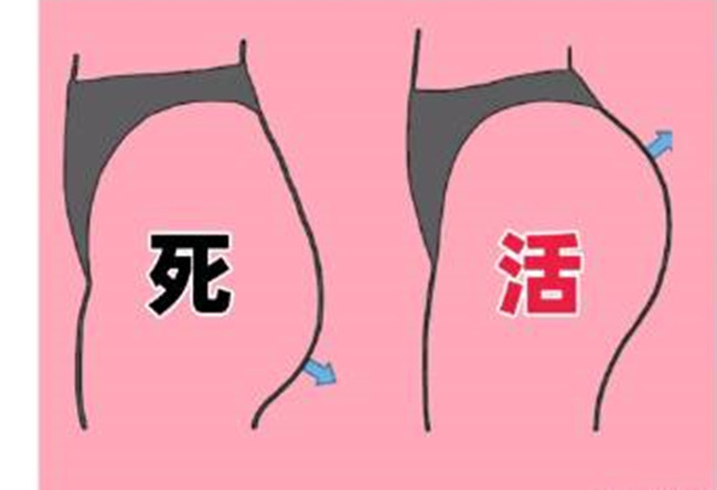 如何改善你臀部的健康情況？南寧美容形象