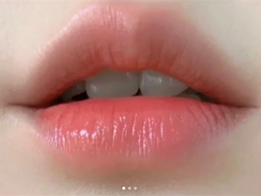 廣西學(xué)紋唇：紋唇遇到組織液時(shí)如何應(yīng)付？